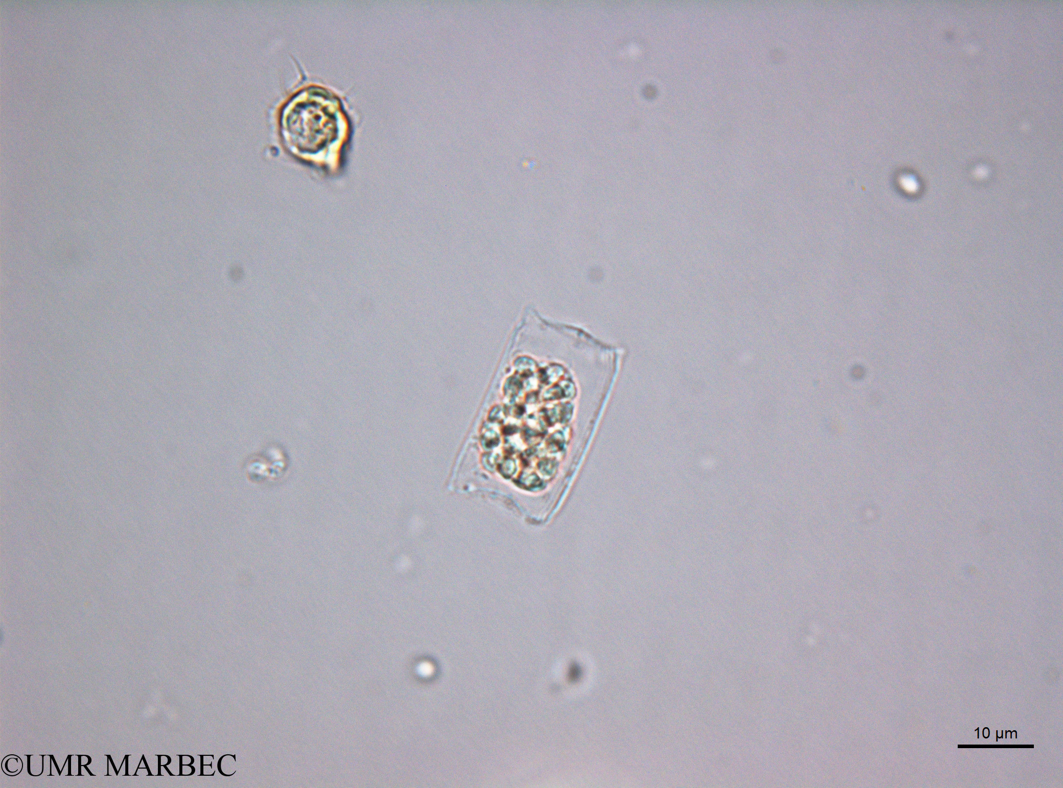 phyto/Scattered_Islands/juan_de_nova/COMMA2 November 2013/Cerataulina sp1 (D5_2_diatomee_ancien_melosira180717_001_ovl-32)(copy).jpg